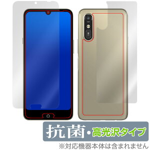 炭炭X}[gtH a A401FC Lite MR01 \ w tB OverLay R Brilliant for X}z ʃZbg RECX 