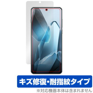 OnePlus 13 ی tB OverLay Magic for vX X}[gtH tی C ώw wh~ R[eBO