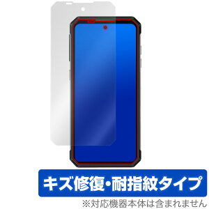 OUKITEL WP21 Ultra ی tB OverLay Magic for IELe X}[gtH tی C ώw wh~ R[eBO