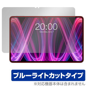 Teclast T60 Plus ی tB OverLay Eye Protector for eNXg ^ubg tی ڂɗD u[CgJbg