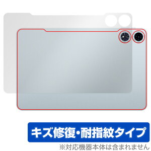 Teclast T60 Plus �w�� �ی� �t�B���� OverLay Magic for �e�N���X�g �^�u���b�g �{�̕ی�t�B���� ���C�� �w��h�~ �R�[�e�B���O