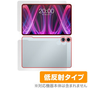 Teclast T60 Plus \ w tB OverLay Plus for eNXg ^ubg \ʁEwʃZbg A`OA ˖h~  wh~