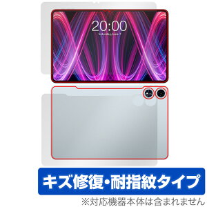 Teclast T60 Plus \ w tB OverLay Magic for eNXg ^ubg \ʁEwʃZbg C ώw wh~ R[eBO