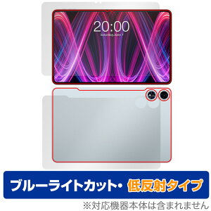 Teclast T60 Plus \ w tB OverLay Eye Protector ᔽ for eNXg ^ubg Zbg u[CgJbg ˖h~