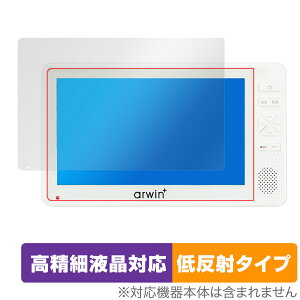 �A�[�E�B�� 7�C���` �h���t���Z�O�e���r��FM���C�h���W�I ABW-700W ABW-7BK �ی� �t�B���� OverLay Plus Lite �����׉t�� �A���`�O���A