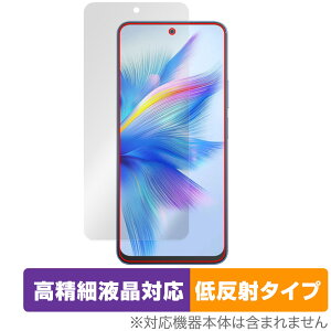 Blackview SHARK 9 ی tB OverLay Plus Lite for ubNr[ V[N ׉t A`OA ˖h~  wh~