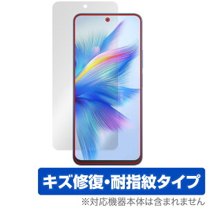 Blackview SHARK 9 ی tB OverLay Magic for ubNr[ V[N tی C ώw wh~ R[eBO