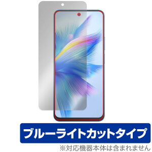 Blackview SHARK 9 ی tB OverLay Eye Protector for ubNr[ V[N tی ڂɗD u[CgJbg