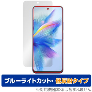 Blackview SHARK 9 ی tB OverLay Eye Protector ᔽ for ubNr[ V[N tی u[CgJbg ˖h~