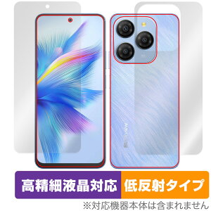 Blackview SHARK 9 \ w tB OverLay Plus Lite for ubNr[ V[N ׉tA`OA ˖h~ wh~