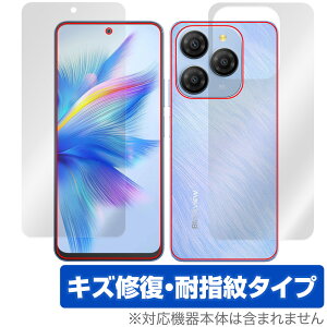 Blackview SHARK 9 \ w tB OverLay Magic for ubNr[ V[N C ώw wh~ R[eBO