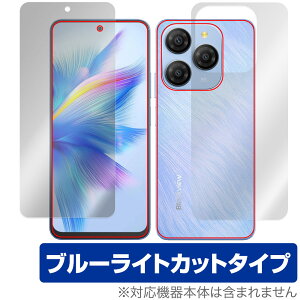 Blackview SHARK 9 \ w tB OverLay Eye Protector for ubNr[ V[N ڂɗD u[CgJbg