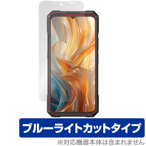 CUBOT KingKong X Pro �ی� �t�B���� OverLay Eye Protector for �L���[�{�b�g �L���O�R���O �t���ی� �ڂɗD���� �u���[���C�g�J�b�g