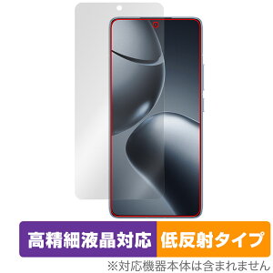 Xiaomi 14T Pro �ی� �t�B���� OverLay Plus Lite for �V���I�~�[ �X�}�[�g�t�H�� �����׉t���Ή� �A���`�O���A ���˖h�~ ����� �w��h�~