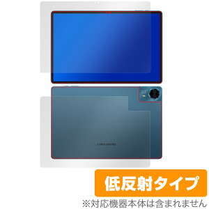 Teclast T70 \ w ی tB OverLay Plus for eNXg ^ubg \ʁEwʃZbg A`OA ˖h~  wh~