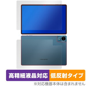 Teclast T70 \ w ی tB OverLay Plus Lite for eNXg ^ubg ׉t A`OA ˖h~  wh~