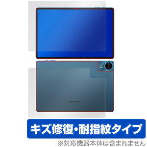 Teclast T70 \ w ی tB OverLay Magic for eNXg ^ubg \ʁEwʃZbg C ώw wh~ R[eBO