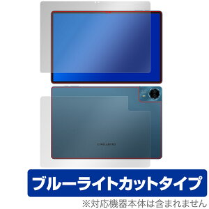 Teclast T70 \ w ی tB OverLay Eye Protector for eNXg ^ubg ڂɗD u[CgJbg