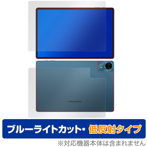 Teclast T70 \ w ی tB OverLay Eye Protector ᔽ for eNXg ^ubg u[CgJbg ˖h~