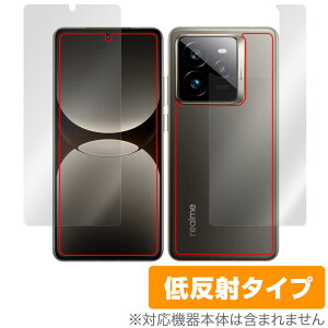 realme GT7 Pro \ w یtB OverLay Plus for A~[ X}[gtH W[eB[ A`OA ˖h~  wh~