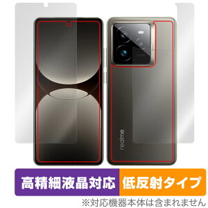 realme GT7 Pro \ w یtB OverLay Plus Lite for A~[ W[eB[ ׉t A`OA ˖h~ wh~