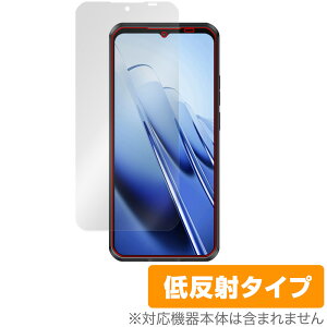 OUKITEL WP52 �ی� �t�B���� OverLay Plus for �I�E�L�e�� �X�}�[�g�t�H�� �t���ی� �A���`�O���A ���˖h�~ ����� �w��h�~