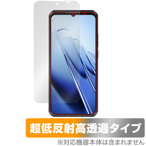 OUKITEL WP52 �ی� �t�B���� OverLay Plus Premium for �I�E�L�e�� �X�}�[�g�t�H�� �t���ی� �A���`�O���A ���˖h�~ ������ �w��h�~