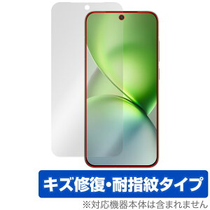vivo X200 Pro mini �ی�t�B���� OverLay Magic for ���B�[���H �G�b�N�X �t���ی� ���C�� �ώw�� �w��h�~ �R�[�e�B���O