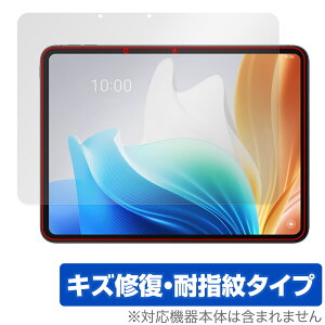 OPPO Pad Neo �ی� �t�B���� OverLay Magic for �I�b�| �^�u���b�g �t���ی� ���C�� �ώw�� �w��h�~ �R�[�e�B���O