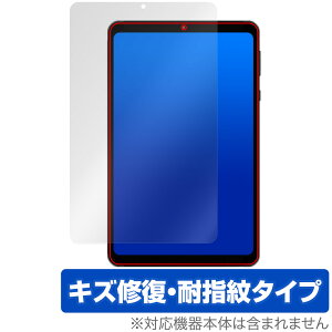 HEADWOLF FPad 6 ی tB OverLay Magic for wbhEt ^ubg tی C ώw wh~ R[eBO