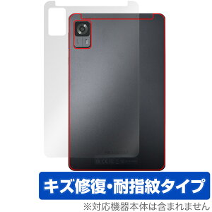 HEADWOLF FPad 6 w ی tB OverLay Magic for wbhEt ^ubg {̕یtB C wh~ R[eBO