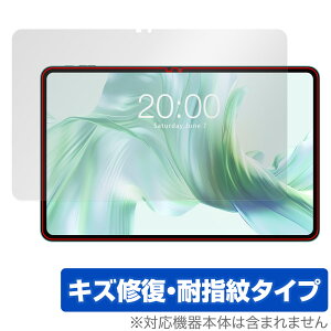 ODEA A12 ی tB OverLay Magic for AhCh ^ubg tی C ώw wh~ R[eBO