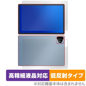 ALLDOCUBE iPlay 60 Pro \ w tB OverLay Plus Lite for I[hL[u ׉tΉ A`OA ˖h~ wh~