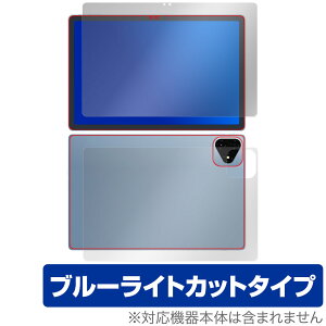 ALLDOCUBE iPlay 60 Pro \ w tB OverLay Eye Protector for I[hL[u ڂɗD u[CgJbg