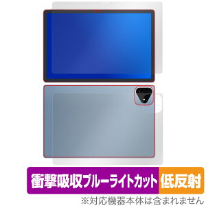 ALLDOCUBE iPlay 60 Pro \ w tB OverLay Absorber ᔽ for I[hL[u Ռz ˖h~ u[CgJbg R