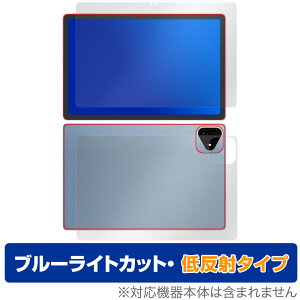 ALLDOCUBE iPlay 60 Pro \ w tB OverLay Eye Protector ᔽ for I[hL[u u[CgJbg ˖h~
