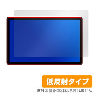 AvidPad S60 ی tB OverLay Plus for Arhpbh ^ubg tی A`OA ˖h~  wh~