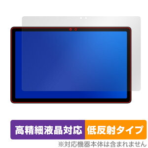 AvidPad S60 �ی� �t�B���� OverLay Plus Lite for �A�r�h�p�b�h �^�u���b�g �����׉t���Ή� �A���`�O���A ���˖h�~ ����� �w��h�~