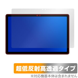 AvidPad S60 ی tB OverLay Plus Premium for Arhpbh ^ubg tی A`OA ˖h~  wh~