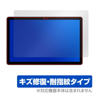 AvidPad S60 ی tB OverLay Magic for Arhpbh ^ubg tی C ώw wh~ R[eBO