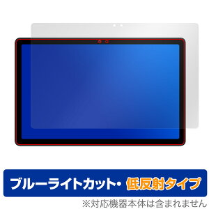 AvidPad S60 ی tB OverLay Eye Protector ᔽ for Arhpbh ^ubg tی u[CgJbg ˖h~