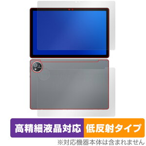 AvidPad S60 \ w tB OverLay Plus Lite for Arhpbh ^ubg ׉tΉ A`OA ˖h~  wh~
