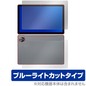 AvidPad S60 \ w tB OverLay Eye Protector for Arhpbh ^ubg ڂɗD u[CgJbg