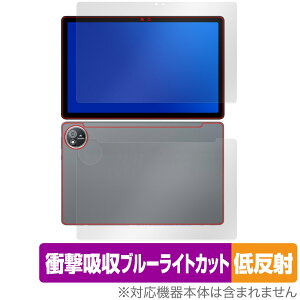AvidPad S60 \ w tB OverLay Absorber ᔽ for Arhpbh ^ubg Ռz ˖h~ u[CgJbg R