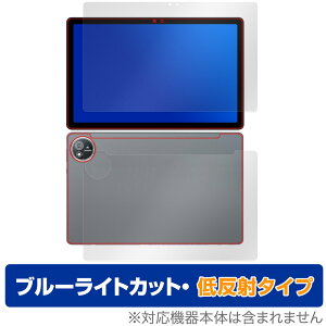 AvidPad S60 \ w tB OverLay Eye Protector ᔽ for Arhpbh ^ubg u[CgJbg ˖h~