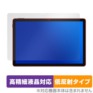 DOOGEE U11 ی tB OverLay Plus Lite for hD[W[ ^ubg ׉tΉ A`OA ˖h~  wh~