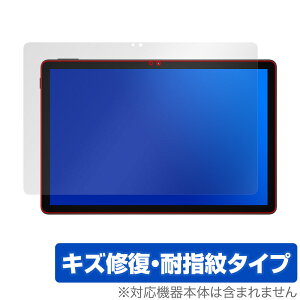 DOOGEE U11 ی tB OverLay Magic for hD[W[ ^ubg tی C ώw wh~ R[eBO