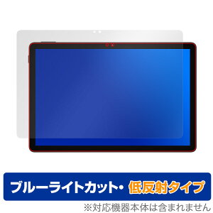 DOOGEE U11 ی tB OverLay Eye Protector ᔽ for hD[W[ ^ubg tی u[CgJbg ˖h~