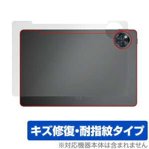 DOOGEE U11 w ی tB OverLay Magic for hD[W[ ^ubg {̕یtB C wh~ R[eBO