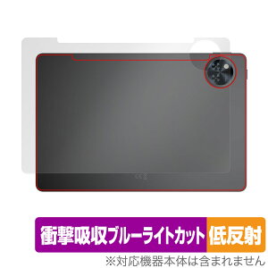 DOOGEE U11 w ی tB OverLay Absorber ᔽ for hD[W[ ^ubg Ռz ˖h~ R